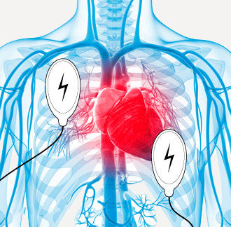 Task 3.4.2 - Synchronized Cardioversion - Bend Fire Training
